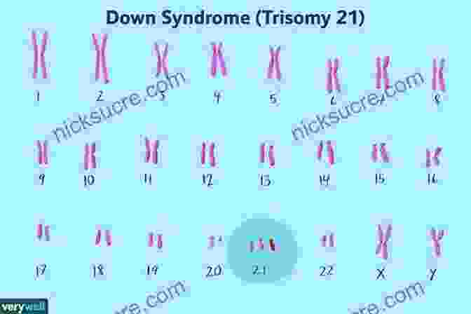 Children With Down Syndrome, A Genetic Condition Caused By Extra Copies Of Chromosome 21 Creation (Movie Tie In): Darwin His Daughter Human Evolution